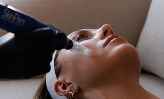Microneedling with PRP: The Glow-Up Combo Everyone's Talking About